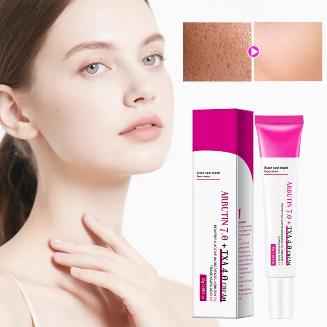 ত্বকের জেদি দাগ দূর করার গোপন সমাধান: Arbutin 7% + TXA 4% Cream!