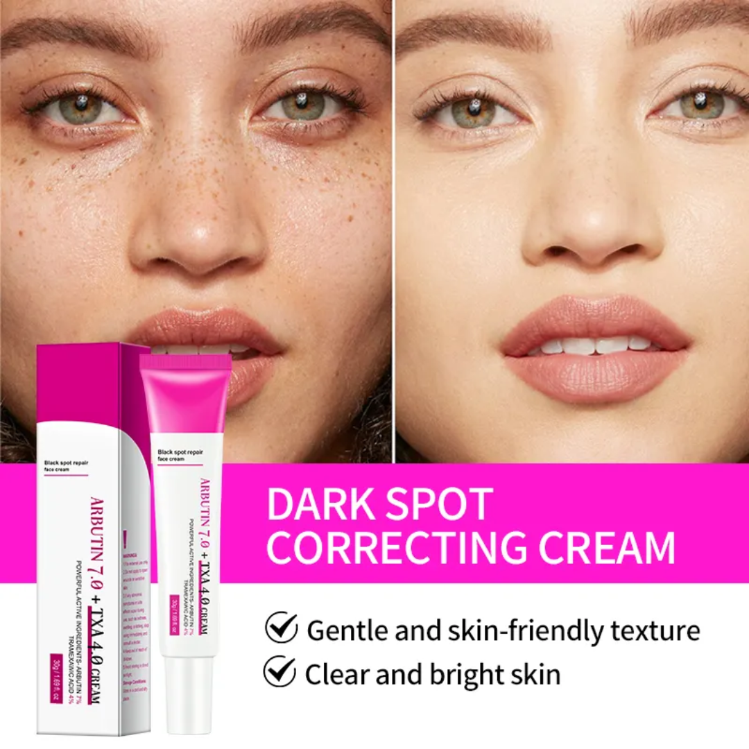 ত্বকের জেদি দাগ দূর করার গোপন সমাধান: Arbutin 7% + TXA 4% Cream!