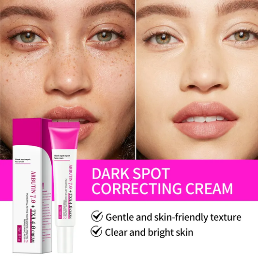 ত্বকের জেদি দাগ দূর করার গোপন সমাধান: Arbutin 7% + TXA 4% Cream!